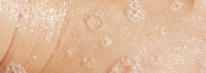 Европейская версия CeraVe Очищающий гель для умывания нормальной и жирной кожи