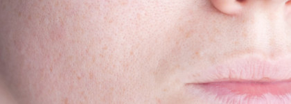 Смогут или нет? Салфетки для удаления черных точек Ciracle Pore Control Blackhead Off Sheet