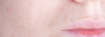 Смогут или нет? Салфетки для удаления черных точек Ciracle Pore Control Blackhead Off Sheet