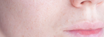 Смогут или нет? Салфетки для удаления черных точек Ciracle Pore Control Blackhead Off Sheet