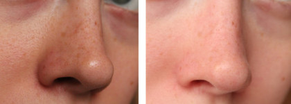 Сравнение чёрной и белой масок GlamGlow. Youthmud Tinglexfoliate Treatment и Clearing supermud treatment