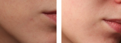Сравнение чёрной и белой масок GlamGlow. Youthmud Tinglexfoliate Treatment и Clearing supermud treatment