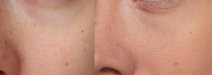 Chanel Perfection Lumiere Velvet Тональный флюид SPF 15 в оттенке 22 Beige Rose