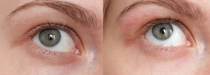 Рабочие гидрогелевые патчи для глаз с зеленым чаем JayJun Green Tea Eye Gel Patches