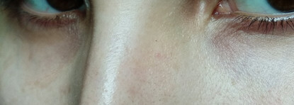 Secret KEY Hyaluron Soft Micro-Peel Toner - мощное увлажнение и кислоты