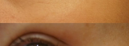 MIXIT Injection Active Eye Cream. Мой взгляд на этот крем спустя 2 месяца использования