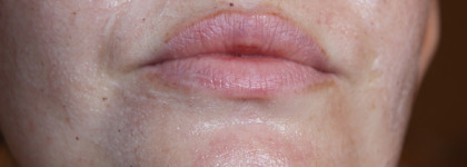 Восстанавливающая маска с пробиотиком Berryglow Probiotic Recovery Mask