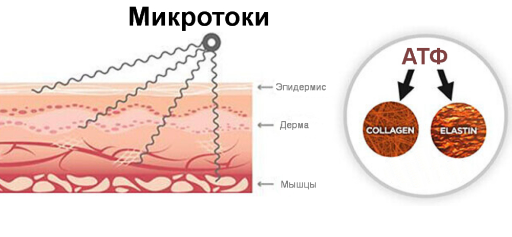 Крайняя правая пружинка отображает EMS - самый сильный ток, проникающий в мышечный слой.