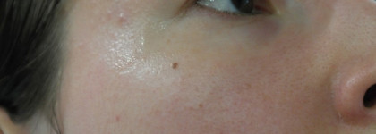 ВВ крем Limoni Aquamax moisture bb cream отлично маскирует поры и мелкие несовершенства на лице, фото до и после