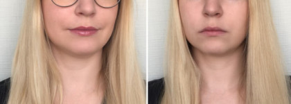 Yves Rocher Очищающий мицеллярный шампунь с экстрактом семян моринги