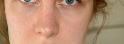 Мой корейский уход: очищение пор и устранение чёрных точек с Ciracle