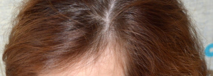 Мицеллярный очищающий кондиционер Schwarzkopf Professional Bonacure Moisture Kick: интенсивное увлажнение... или нет?