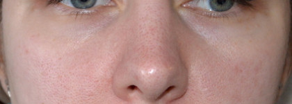 SOS или не SOS - вот в чем вопрос