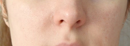 Моя прелесть: тоник Bisou Увлажнение и Свежесть, без которого моя кожа жирная