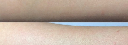 Вечерний ароматный ритуал вместе с Huile Lotus Face Treatment Oil, Clarins