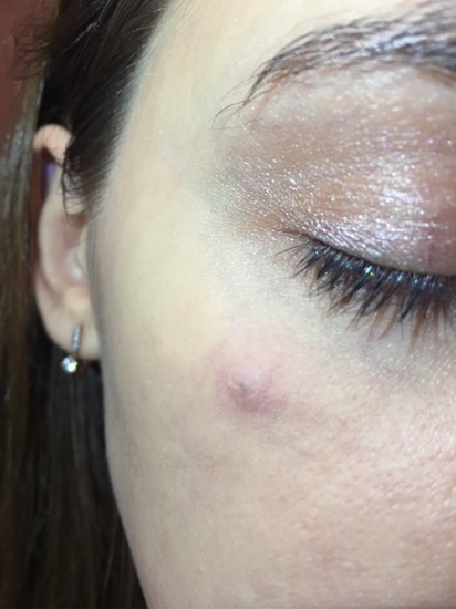 Скорая помощь при воспалении: Guerlain Stop Spot Anti-Blemish Treatment