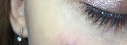 Скорая помощь при воспалении: Guerlain Stop Spot Anti-Blemish Treatment