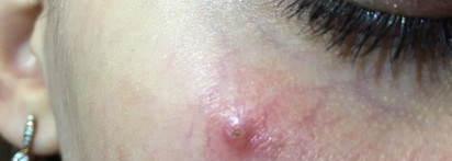 Скорая помощь при воспалении: Guerlain Stop Spot Anti-Blemish Treatment