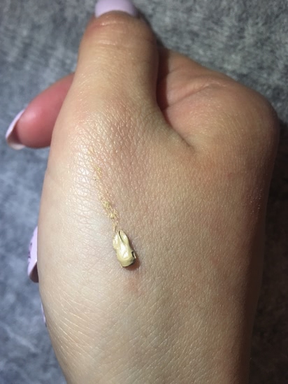 Скорая помощь при воспалении: Guerlain Stop Spot Anti-Blemish Treatment