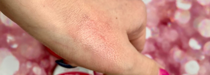 Сухие,обветренные губы? Есть решение! Коллекция бальзамов для губ