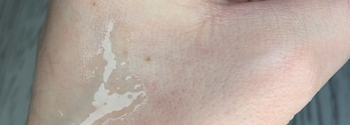 Рейтинг средств для сияния кожи и ровного тона (с витамином С и не только)