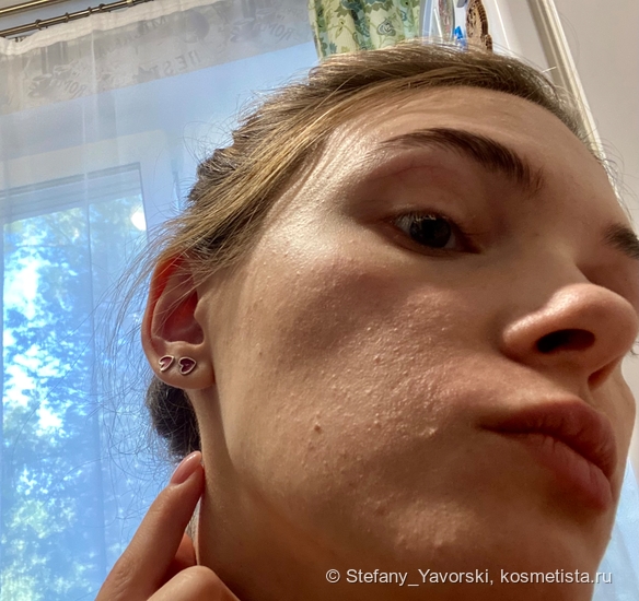 Супергерои для борьбы с комедонами: Sesderma, Camomilla Blu, Manyo