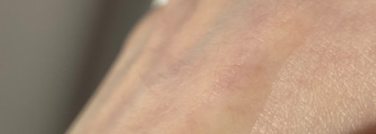 Супергерои для борьбы с комедонами: Sesderma, Camomilla Blu, Manyo