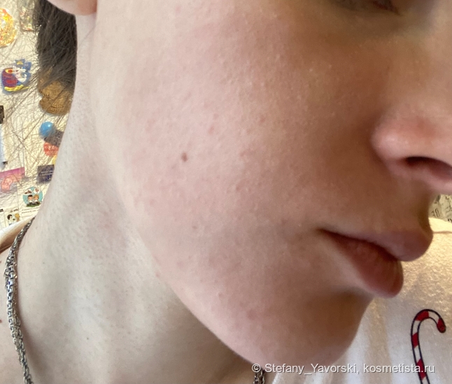 Супергерои для борьбы с комедонами: Sesderma, Camomilla Blu, Manyo