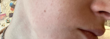 Супергерои для борьбы с комедонами: Sesderma, Camomilla Blu, Manyo