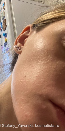Супергерои для борьбы с комедонами: Sesderma, Camomilla Blu, Manyo