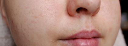 Пилинг для лица Noreva Exfoliac Facial Scrub.«И пусть думают, что это пластика…»