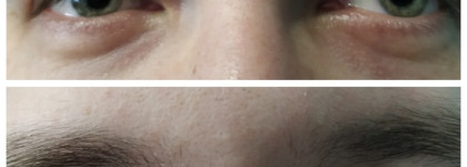 Вождь разнокожих - Патчи с микроиглами с растительным кофеином BLOM Microneedle Eye Patches. (+Затест на мужской коже)