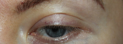 The Ordinary Caffeine Solution 5% + Egcg - боремся с отеками и темными кругами под глазами