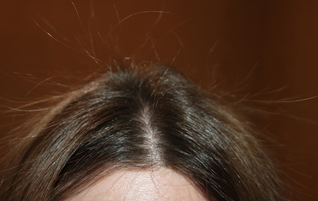 Керастаз для волос ампулы от выпадения волос