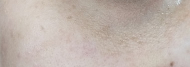 Биочистка содой и солью с последующей компенсацией