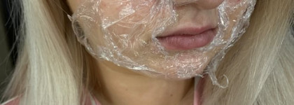 Мой опыт очистки пор методом холодного гидрирования. Осторожно - не самые эстетичные фото