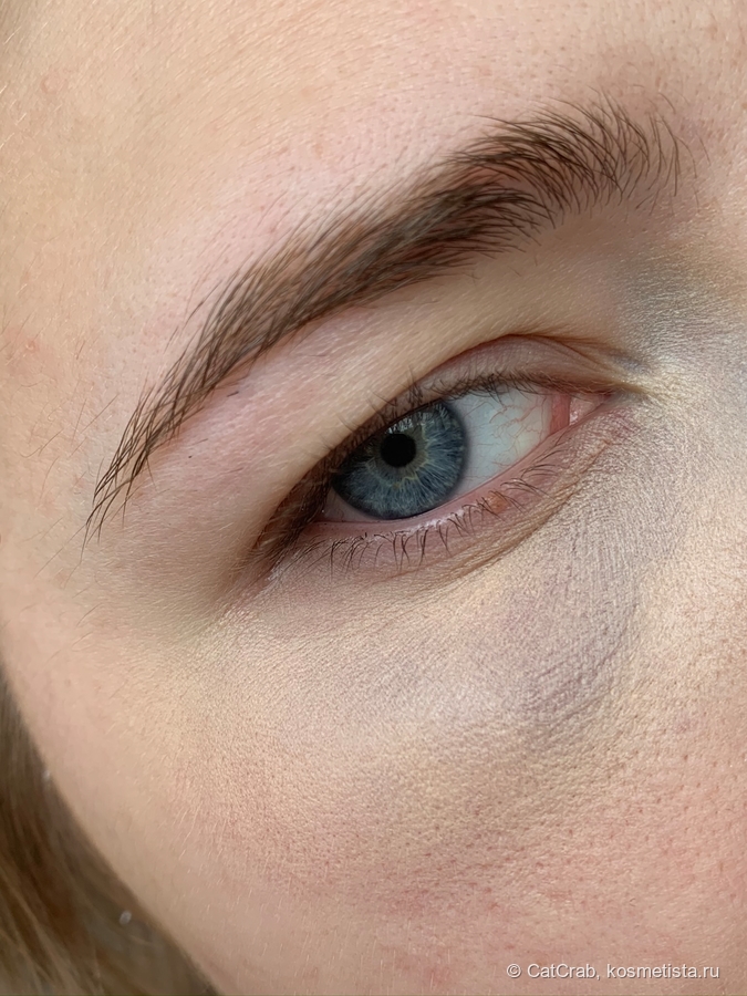 Как правильно закрасить синяки под глазами