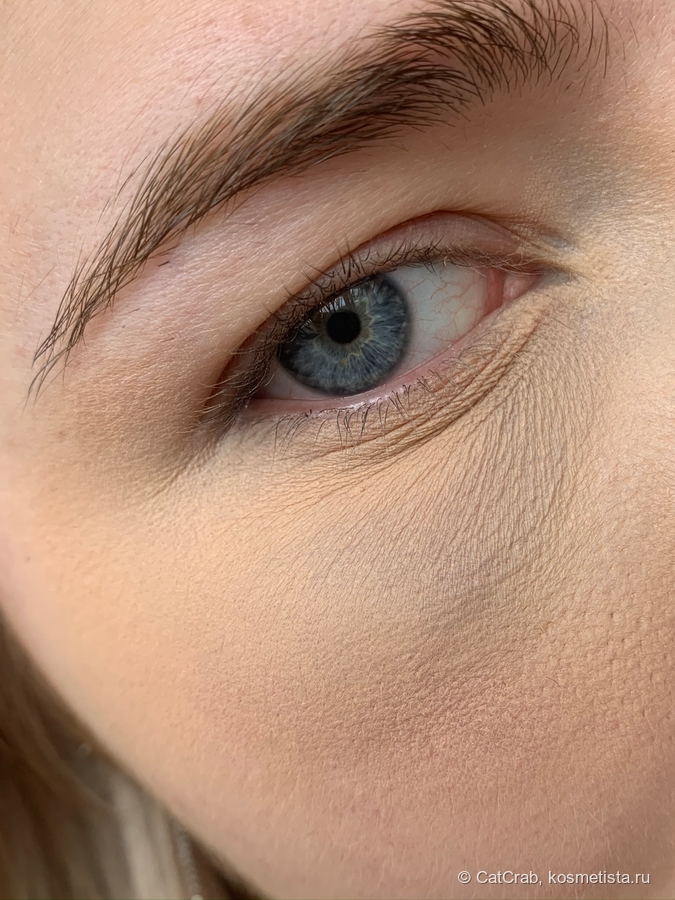 Как убрать синяки под глазами, поможет ли мазь от ушибов