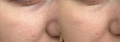 Консилер Perfect Concealer 01 от Shik. Любимец последнего времени