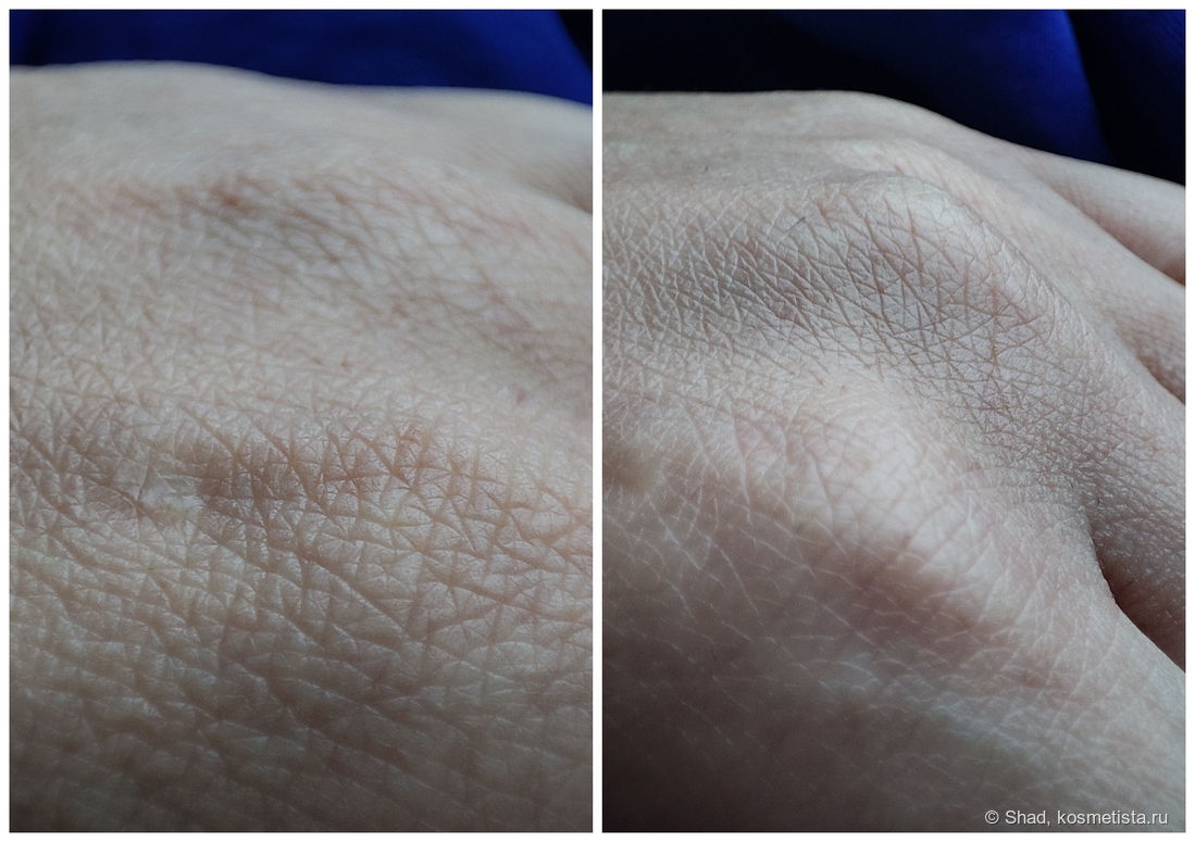 Состояние кожи рук до и после нанесения крема
