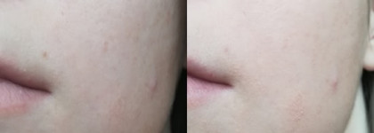 Бледнолицая сестра и Erborian BB крем с женьшенем