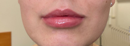 Прямой конкурент блескам от SHIK. New! Блеск для губ от с эффектом объема Luxvisage Icon lips glossy volume в оттенке 506