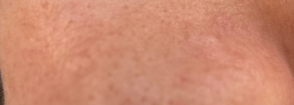 Сможет ли ультразвуковой скрабер U-Sonic от Olzori заменить поход к косметологу?