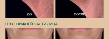 Мой опыт ухода. Крем Vichy Neovadiol Phytosculpt в комплексе с массажем лица