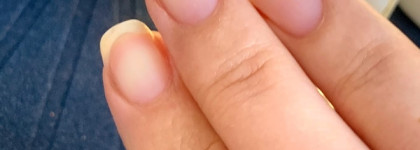 Формальдегид, что за зверь?! Может ли он стать моей прелестью?