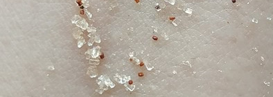 Мои главные средства борьбы с целлюлитом