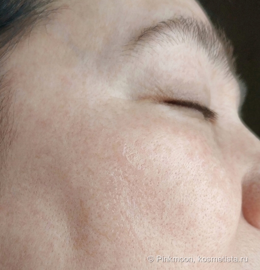 Сужающий поры лосьон для глубокого очищения проблемной кожи Vichy Normaderm Purifying Pore-Tightening Lotion