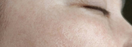 Сужающий поры лосьон для глубокого очищения проблемной кожи Vichy Normaderm Purifying Pore-Tightening Lotion