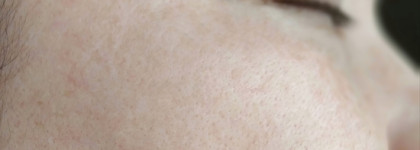 Сужающий поры лосьон для глубокого очищения проблемной кожи Vichy Normaderm Purifying Pore-Tightening Lotion