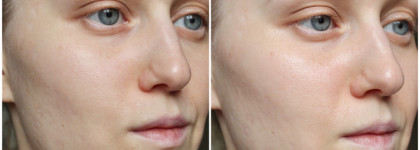 La Roche-Posay Toleriane Sensitive Riche против сухой кожи 30+